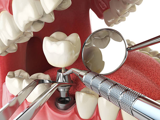 Best Emergency Dentist for Knocked-Out Tooth in Alamosa East, CO